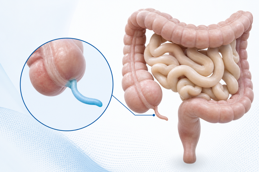 Ilustración educativa del apéndice, intestino delgado y colon